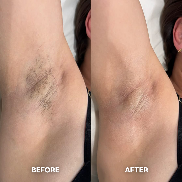 TAILEDEN™ Hair Removal Cream for All Women & Men